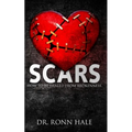 Scars: How to Be Healed from Brokenness